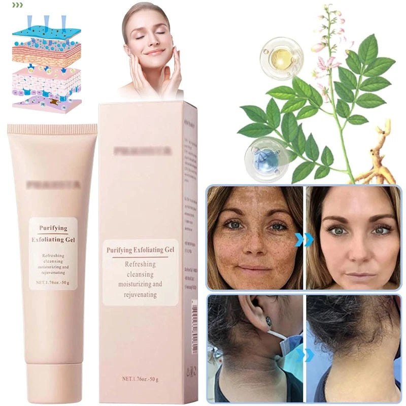 Quarxery Gel Exfoliante | ADIOS A LAS MANCHAS,GRASAS Y PUNTOS NEGROS