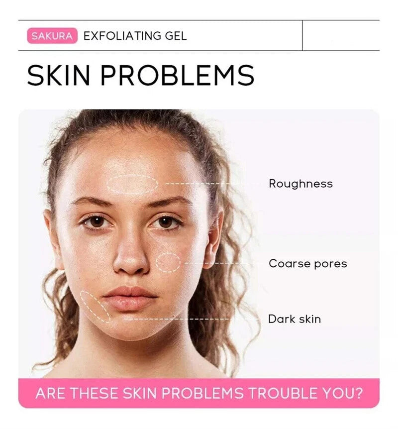 Quarxery Gel Exfoliante | ADIOS A LAS MANCHAS,GRASAS Y PUNTOS NEGROS